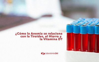 ¿Cómo la Anemia puede estar relacionados con la Tiroides, el Hierro y la Vitamina D?