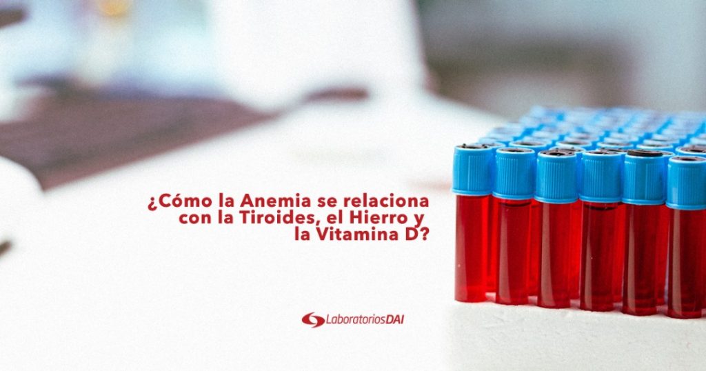 ¿Cómo la Anemia puede estar relacionados con la Tiroides, el Hierro y la Vitamina D?